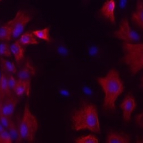 © Unité Neurobiologie intégrative des systèmes cholinergiques – Institut Pasteur
