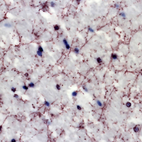 © Andry Andrianarivelo et Peter Vanhoutte - Laboratoire Neuroscience Paris-Seine (CNRS/Sorbonne Université/Inserm)