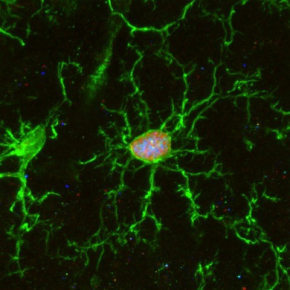 © K. SAILOR / PM LLEDO, Institut Pasteur